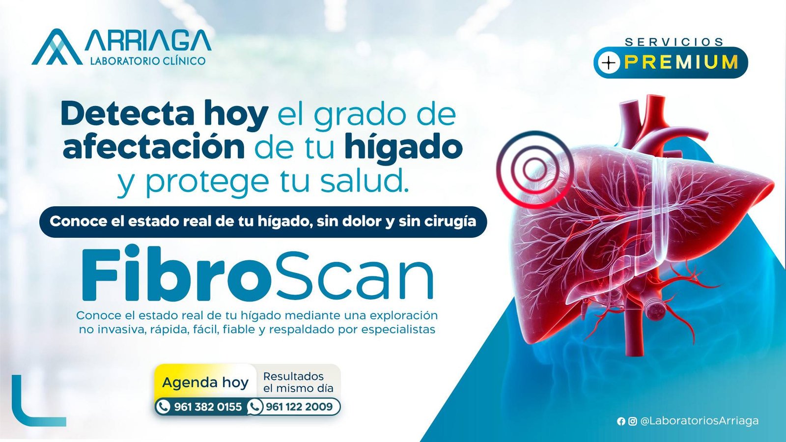 Inicio fibroscan